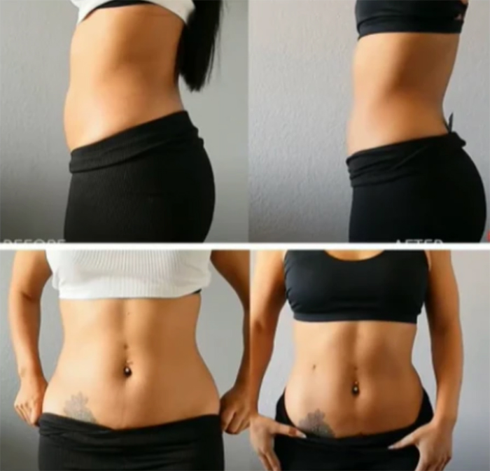 Cavitation-Machine-aug24-img-1